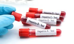 “Birinci derece yakınlarında hepatit olanlar mutlaka taramadan geçmeli"