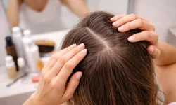 "Kadınlarda saç dökülmesinin gizli nedenleri"