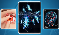 Gözünüzü ovalamayın, paraziti beslemeyin!