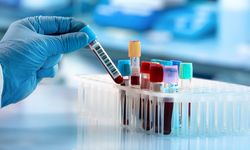 Uzmanından Biotin uyarısı: Kan tahlili öncesi kullanıma ara verilmeli