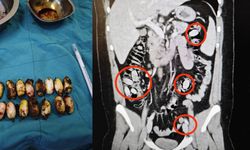 Türk polisinin dikkatinden kaçmadı! Midesinden tam 44 adet çıktı