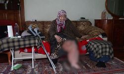 'Fil hastası' kadının feryadı: Sesimi duyun, sokakta kalacağım!