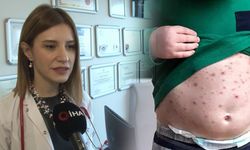 Suçiçeğine dikkat! Vakalar arttı