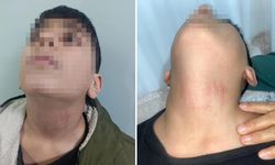 10 yaşındaki öğrenciye okulda darp iddiası