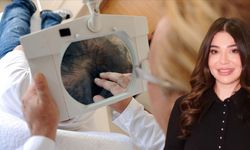 Kadınlara nasıl saç ekimi yapılıyor? İşte cevabı