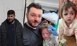 Yalova'daki bebeğe şiddet olayında skandal savunma