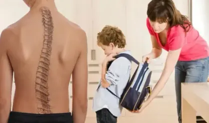 Her 100 çocuktan 3'ü skolyoz riski taşıyor