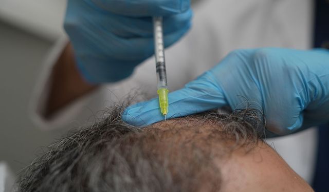 Dökülen saçlar vücudun bir alarmı olabilir