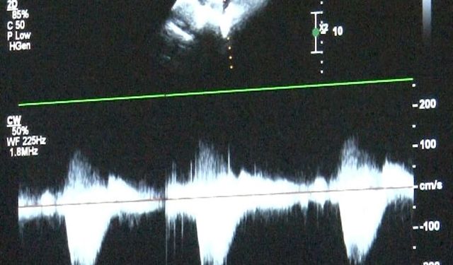 Çocuklarda kalp sağlığına dikkat: "Takipleri düzenli yaptıralım"