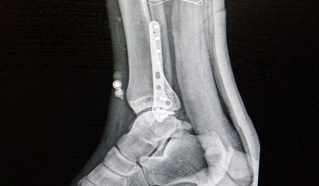 Ortopedi uzmanı tehlikeye karşı uyardı