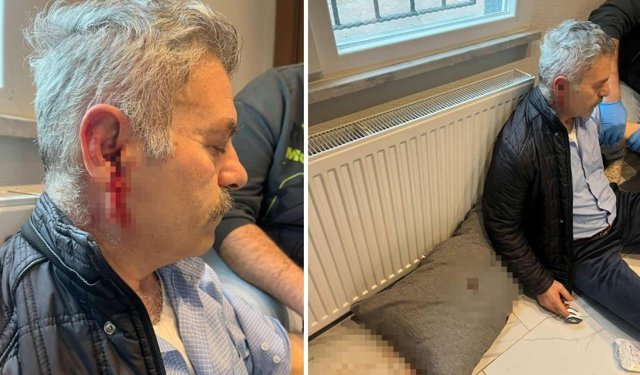 İş yerine çağırdılar, eski çalışanı darbettiler