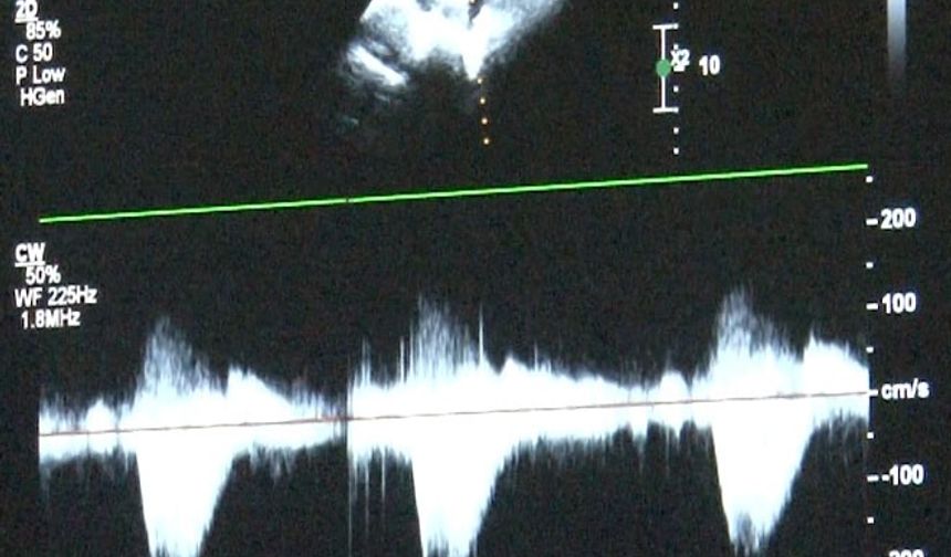 Çocuklarda kalp sağlığına dikkat: "Takipleri düzenli yaptıralım"