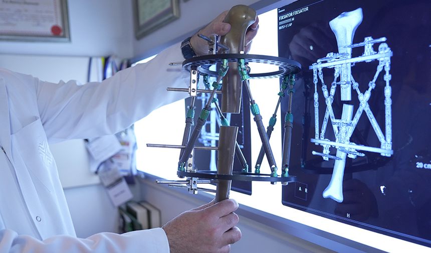 Boy kısalığına karşı modern çözüm: kemik uzatma yöntemleri