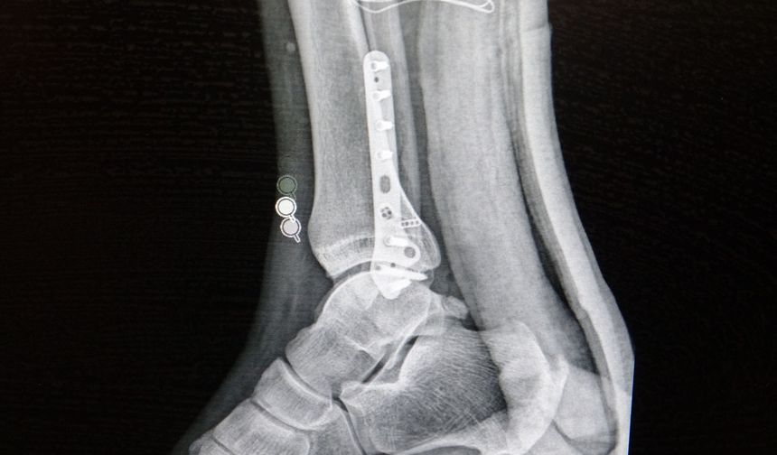 Ortopedi uzmanı tehlikeye karşı uyardı