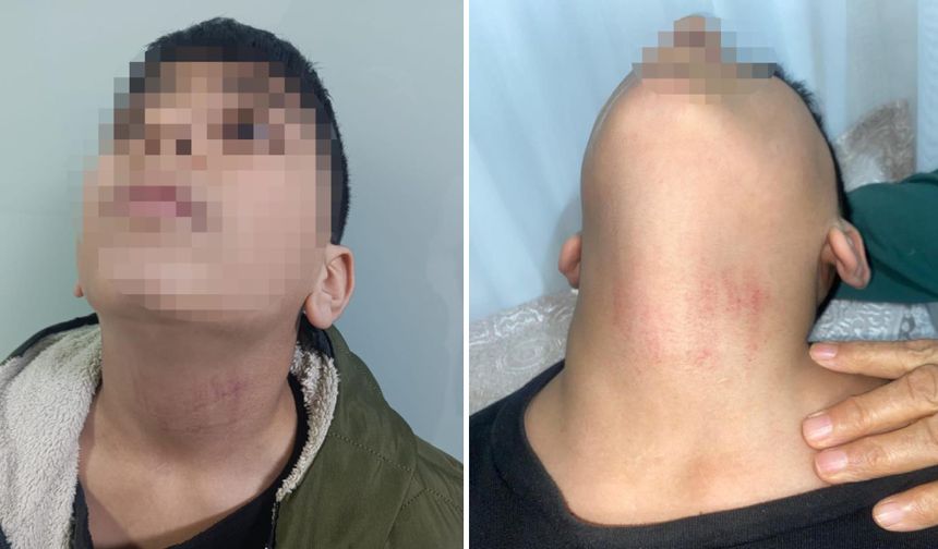 10 yaşındaki öğrenciye okulda darp iddiası