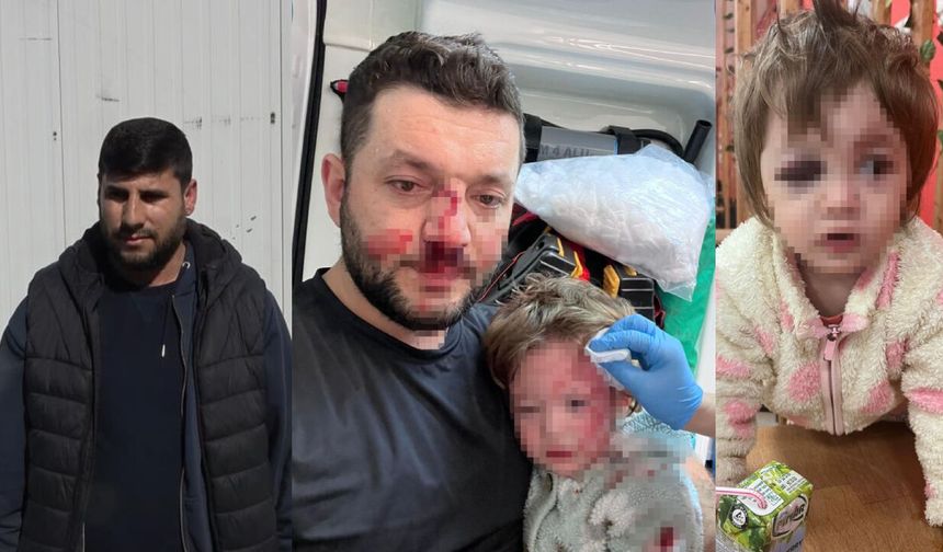 Yalova'daki bebeğe şiddet olayında skandal savunma