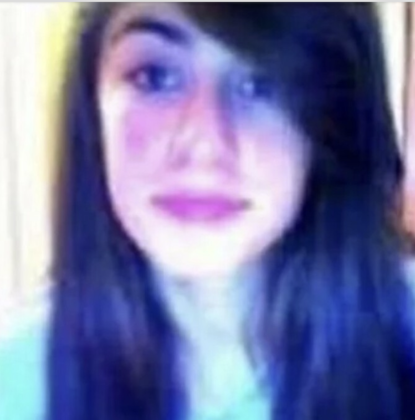 ayça çağla Altunkaya estetiksiz hali