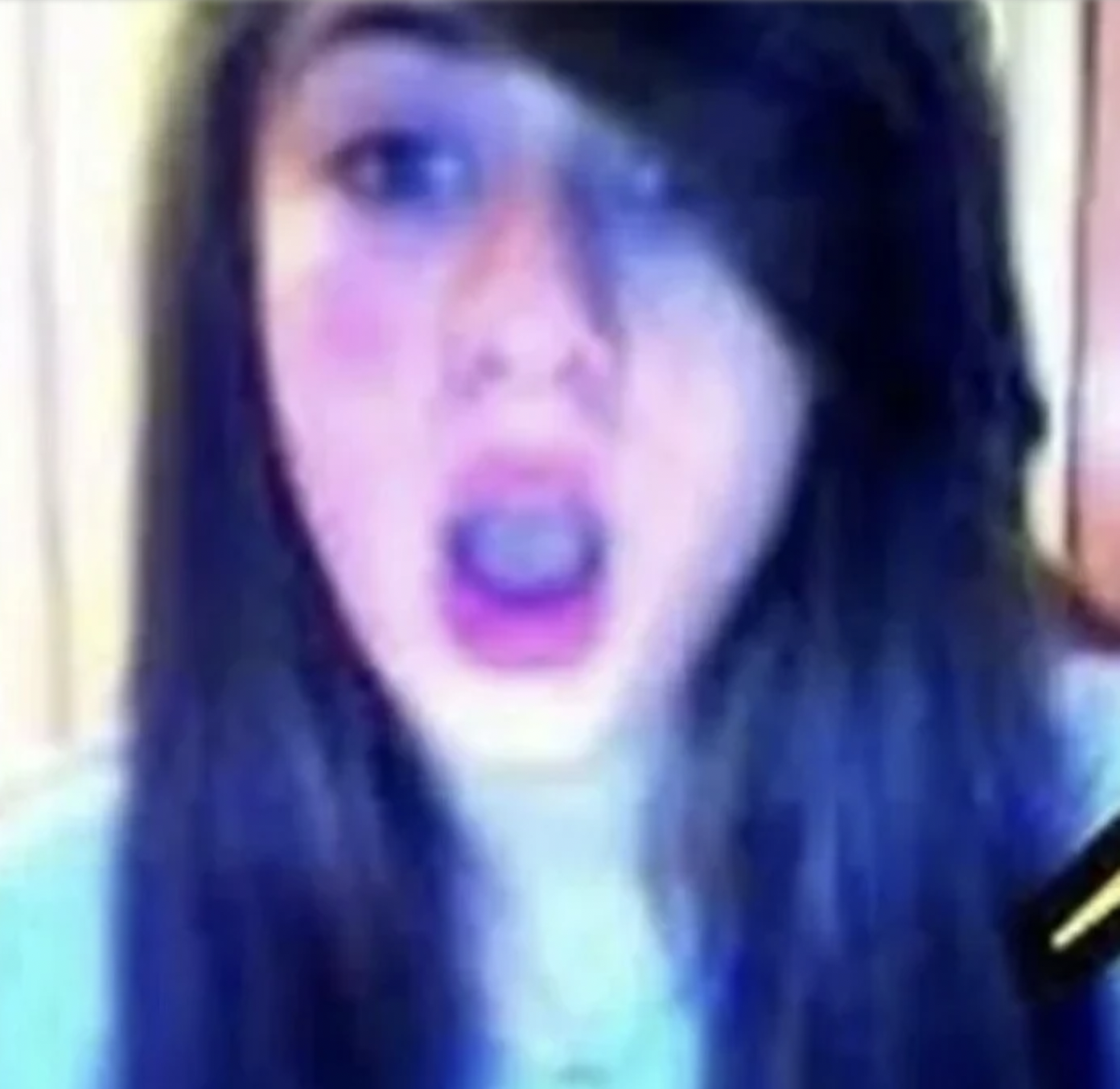 ayça çağla Altunkaya estetiksiz1