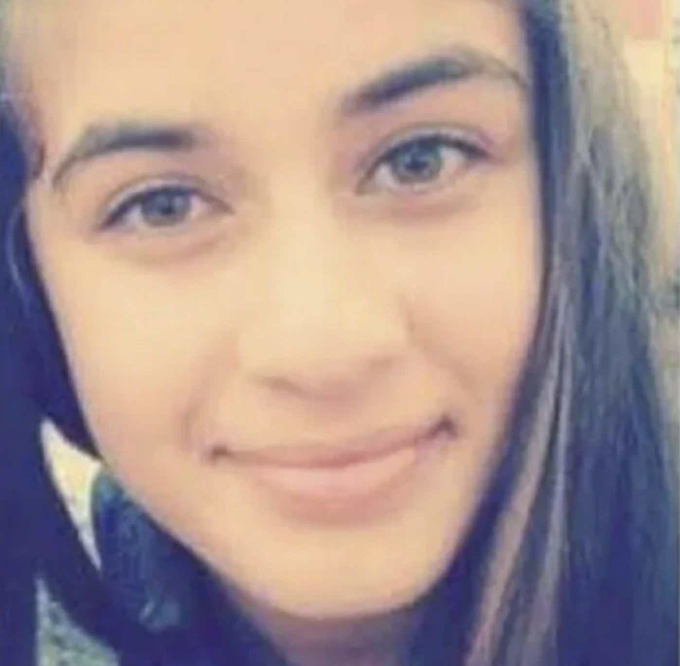 ayça çağla Altunkaya estetiksiz 6