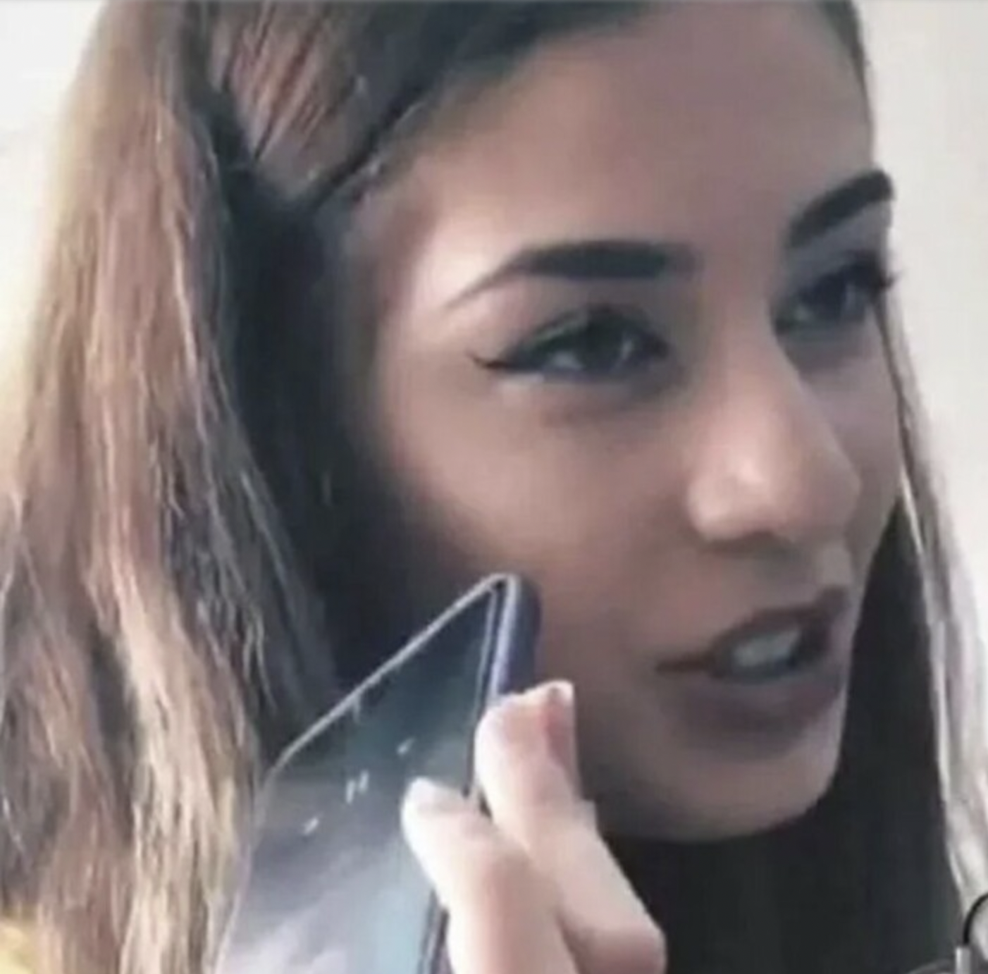 ayça çağla Altunkaya estetiksiz hali3